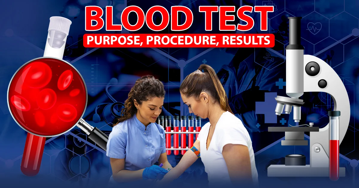 Blood Test: Purpose, Procedure, Results